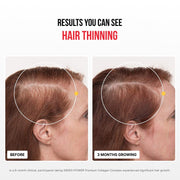 Complejo de Colágeno Premium