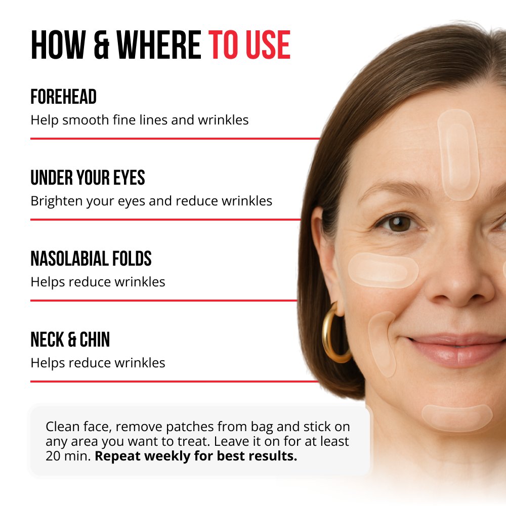 Parches de microagujas autodisolventes